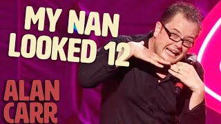 Alan Carr On Holidaying As A Kid  Spexy Beast  Alan Carr [upl. by Nylemaj]