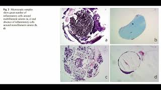 Dragovic et al 2019 [upl. by Yllet]