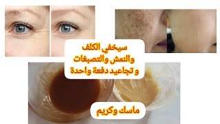 كريم وماسك لإزالة النمش والكلف والتصبغات والتجاعيد جربي وحكمي بنفسك [upl. by Poirer]