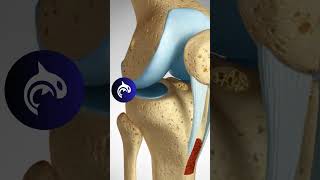 ACL Reconstruction  Patellar Harvest  3D Animation knee kneepain kneerehab [upl. by Eelame]