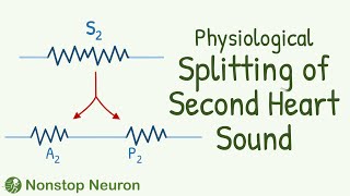 When SUPERMAN Auscultates the Heart Physiological Splitting of Second Heart Sound is heard [upl. by Etteuqaj319]