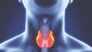 Hyperthyroidism فرط نشاط الغدة الدرقية [upl. by Amri]