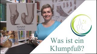 Was ist ein Klumpfuß [upl. by Tdnarb730]