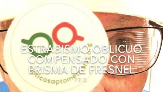 Estrabismo oblicuo compensado con prismas de fresnel [upl. by Iknarf514]