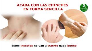 Como Acabar Con Las Chinches De Cama  como deshacerse de las chinches [upl. by Cissie]