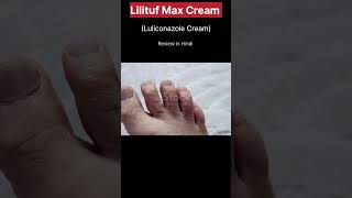 Lilituf Max Cream Use  Ringworm [upl. by Shaina]