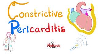 Constrictive Pericarditis  Causes Symptoms Signs Diagnosis amp Management  Cardiology [upl. by Brana]