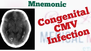 Congenital CytomegalovirusCMV triad Mnemonic [upl. by Anawit]