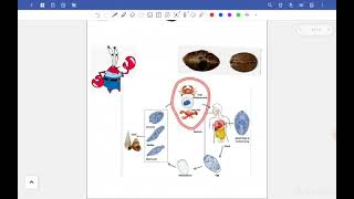 L1 Para Paragonimiasis and House dust mites Resp 42 [upl. by Madelyn989]