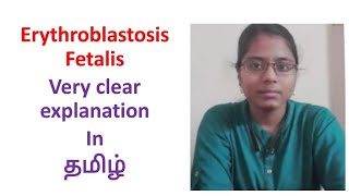 Erythroblastosis Fetalis in Tamil  Very clear explanation ✨ [upl. by Atiekal614]