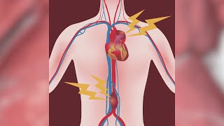 Heart specialists talk dangers of an aortic aneurysm [upl. by Marchese]