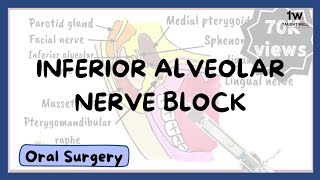 Inferior Alveolar Nerve Block Technique [upl. by Anelim]