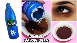 Remove Dark Circles Fast And Overnight  Dark circles under eyes home remedy [upl. by Yarehs]