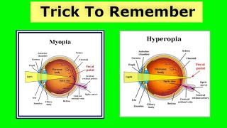 Trick For Myopia amp Hypermetropia Difference [upl. by Labinnah]