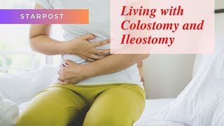 Living with Colostomy and Ileostomy A Comprehensive Guide to Life After Surgery [upl. by Heall]