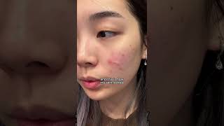 best korean skincare products to restore damaged skin barrier I MANYO BIFIDA TONER amp AMPOULE shorts [upl. by Adkins363]