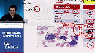 Hematología  12 Neoplasias Leucemias Agudas [upl. by Ecyaj]