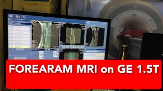 Forearam MRI scan protocol positioning and planning on GE 15 Tesla  Live Demo [upl. by Erena801]