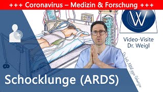 ARDS Akutes Lungenversagen durch Coronavirus amp Influenza – Schocklunge als gefährliche Komplikation [upl. by January420]