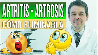 Artritis amp Artrosis  Síntomas causas amp Cómo eliminarla [upl. by Ahsrats]