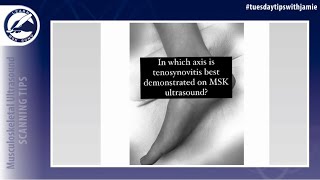 Scan technique for tendons with tenosynovitis in the tendon sheath [upl. by Nonnerb]