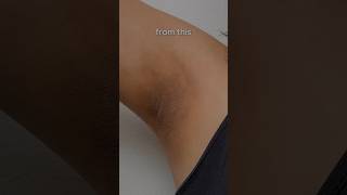 Get rid of dark underarms in minutes shorts youtube beautyhacks skincare homeremedies [upl. by Aldus847]