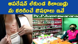 KeloidsCausesSymptomsampTreatment In Telugu  Alpha Homeo Clinics [upl. by Eitra]