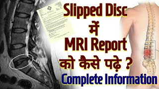 How To Read MRI Report Of SLIPPED DISC  L4L5 L5S1 Sipped Disc DIAGNOSIS  In Hindi [upl. by Annaj]