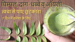 Pimple Daag Dhabbe व Oily Skin से पाए छुटकारा पाए हमेशा के लिए How To Remove Pimple Pimple Marks [upl. by Hootman]