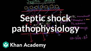 Septic shock  pathophysiology and symptoms  NCLEXRN  Khan Academy [upl. by Ynnaej163]