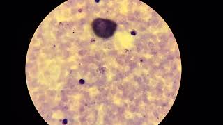 Plasmodium vivax [upl. by Behl]