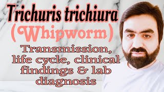 Lec26  Trichuris trichiura  Whipworm  Transmission  life cycle  clinical findings  UrduHindi [upl. by Beuthel]