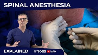 Spinal Anesthesia Explained Part 1 Crash course with Dr Hadzic [upl. by Oiredised]