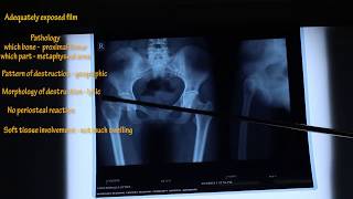 HOW TO READ XRAY PROPERLY IN ORTHOPAEDICS  MADE EASY BY DR BISHNU POKHAREL  PART 2 [upl. by Anrapa]