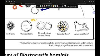 GIT Parasitology Lec 1 Blastocystis hominis [upl. by Nordine]