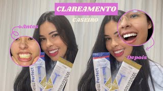 CLAREAMENTO CASEIRO Whiteness Perfect e White Class o melhor produto para clareamento dental [upl. by Trevethick]