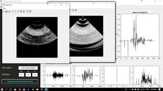 Ultrasound Simulation Application  MatLab [upl. by Esilenna605]