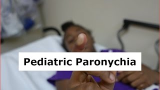 Pediatric Paronychia Drainage [upl. by Yerocaj]