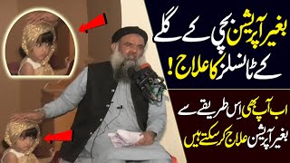 Tonsils Ka Bgair Operate Ilaj  Best Bayan by Dr Sharafat Ali  Latest HD Video [upl. by Yatnod845]