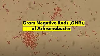 Gram Negative rods of Achromobacter [upl. by Reta562]