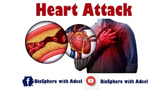 Heart Attack  Myocardial Infraction  MI [upl. by Pattison]