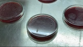 How to make Blood agar mediain house lab technique MICROBIOLOGY Easy and better method explained [upl. by Means]