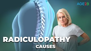 Causes and Treatment Options for Radiculopathy  How To Overcome Radiculopathy [upl. by Gilbertson]