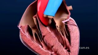 Crioablación tratamiento de las arritmias cardiacas con frío [upl. by Crosse394]