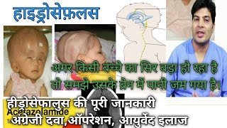 hydrocephalus treatment without surgery  hydrocephalus ka ilaj in hindi  hydrocephalus in hindi [upl. by Aineles]