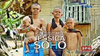 Kapuso Mo Jessica Soho The rare case of poreless skin in four siblings [upl. by Noevart]