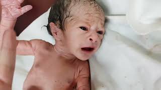 Newborn baby who looks like Old Man after birth with cutest cry IUGR baby love video [upl. by Cindi]