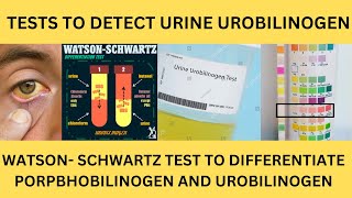 TESTS TO DETECT UROBILINOGEN IN THE URINE EhrlichsTEST PORPHOBILINOGEN TESTWatsonSchwartz Test [upl. by Ellehcam877]