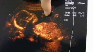 18 Weeks Pregnant Ultrasound Praying Baby [upl. by Parrie]