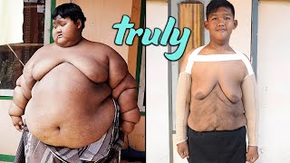 World’s Heaviest Kid Has Saggy Skin Surgery  TRULY [upl. by Krystyna]